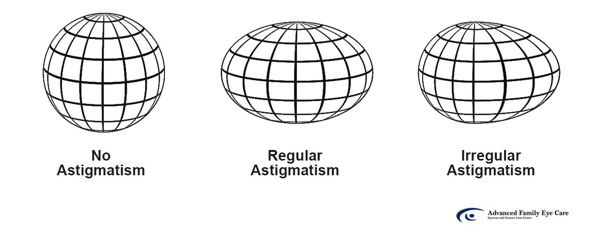 Ce problemă vizuală este creată de astigmatism?