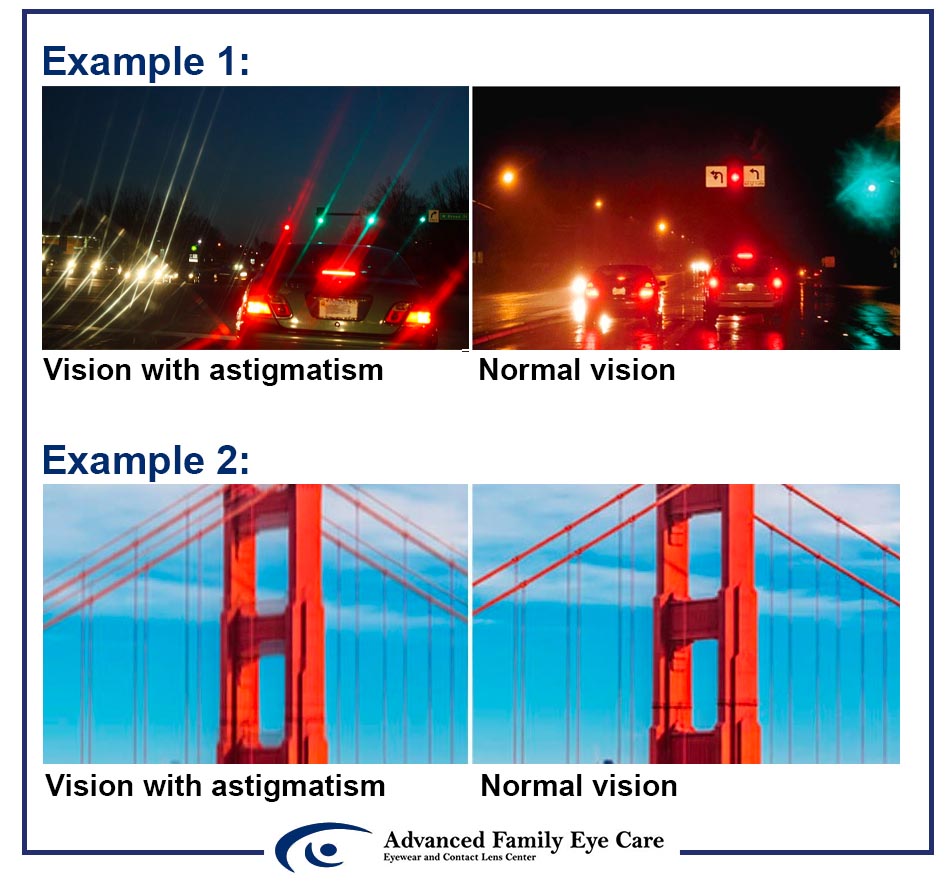 What Does Astigmatism Look Like